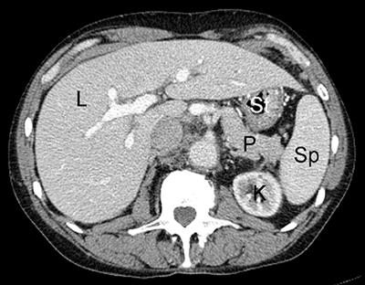 Radiologic Modalities and Response Assessment Schemes for Clinical and Preclinical Oncology Imaging